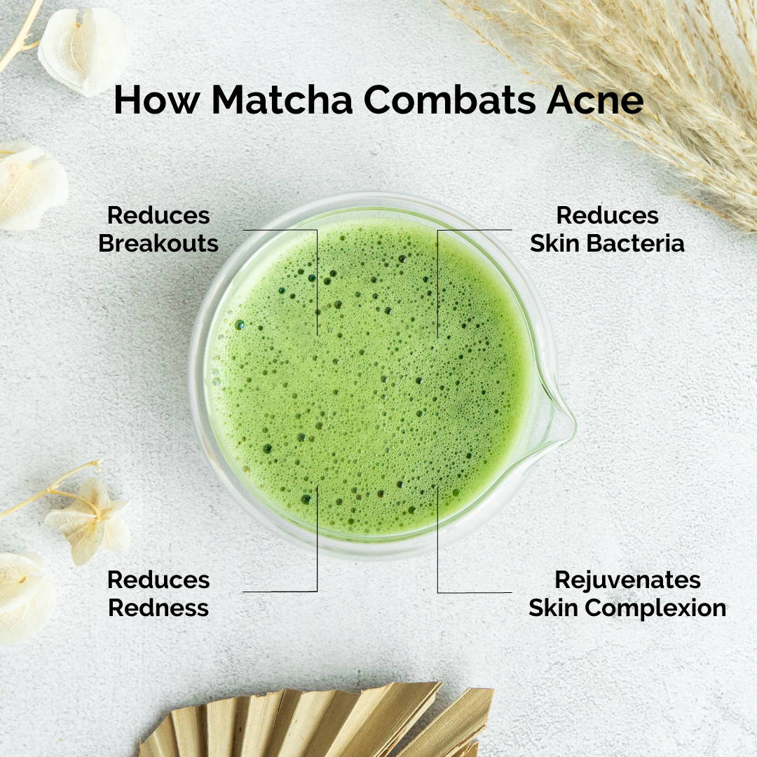 How Matcha Combats Acne Crafti